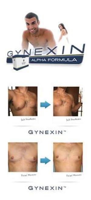 does gynexin really work